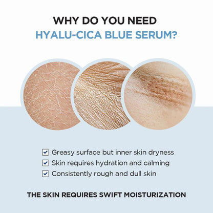 SKIN1004 Madagascar Centella Hyalu-Cica Blue Serum (Mini) 30ml SKIN1004 Skin Care